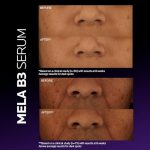 ⁦سيروم الوجه من لاروش بوزيه⁩ - الصورة ⁦2⁩